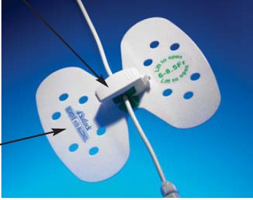 StatLock Universal Plus Stabilization Device, Medium VUPD1012 Qty 25 Per Box