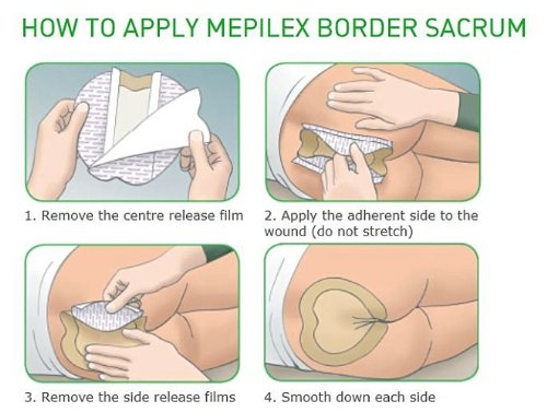 Molnlycke 282000 Mepilex Border Sacrum Adhesive Foam Dressings 7.2x7.2, BX/5