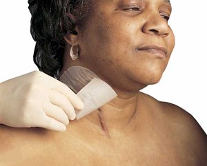 Mepiform Self-Adherent Silicone Dressing. Dimensions: 1&3/5" x 12" ...
